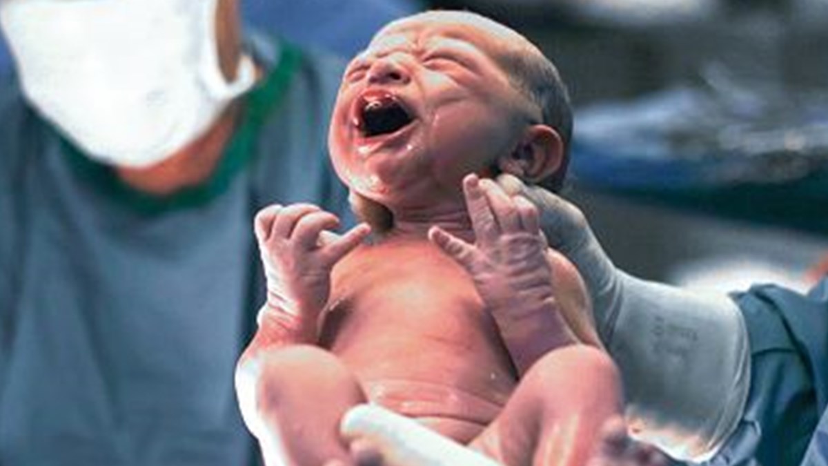 sezaryen sonrasinda da normal dogum