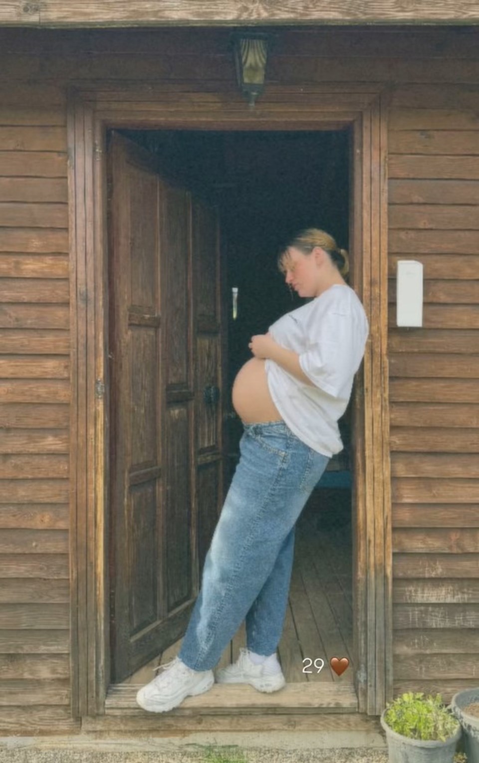 Gizem Karaca'dan karnı burnunda yeni poz - 1