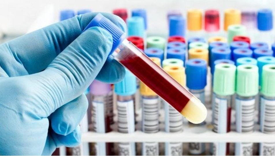PCR testi nedir, nasıl yapılır? - Sağlık Haberleri | NTV