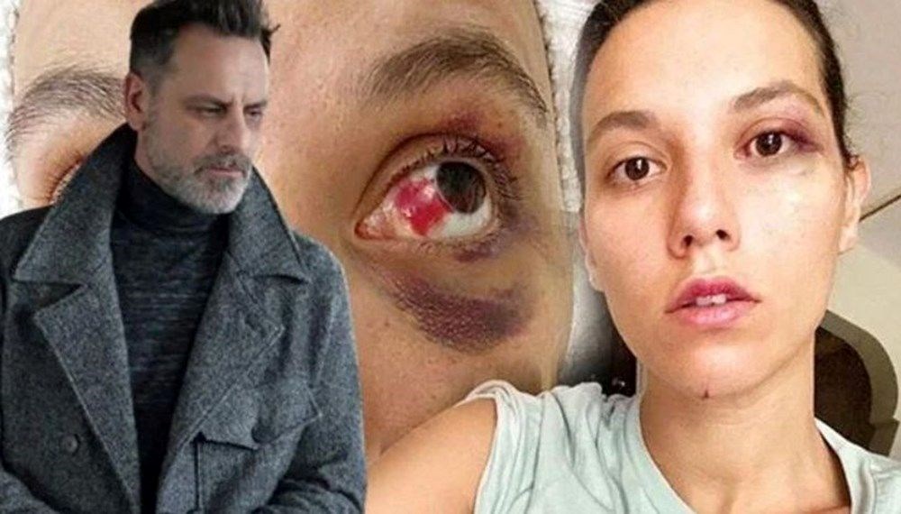 Ceza onandı: Oyuncu Ozan Güven 45 gün hapis yatacak - 3