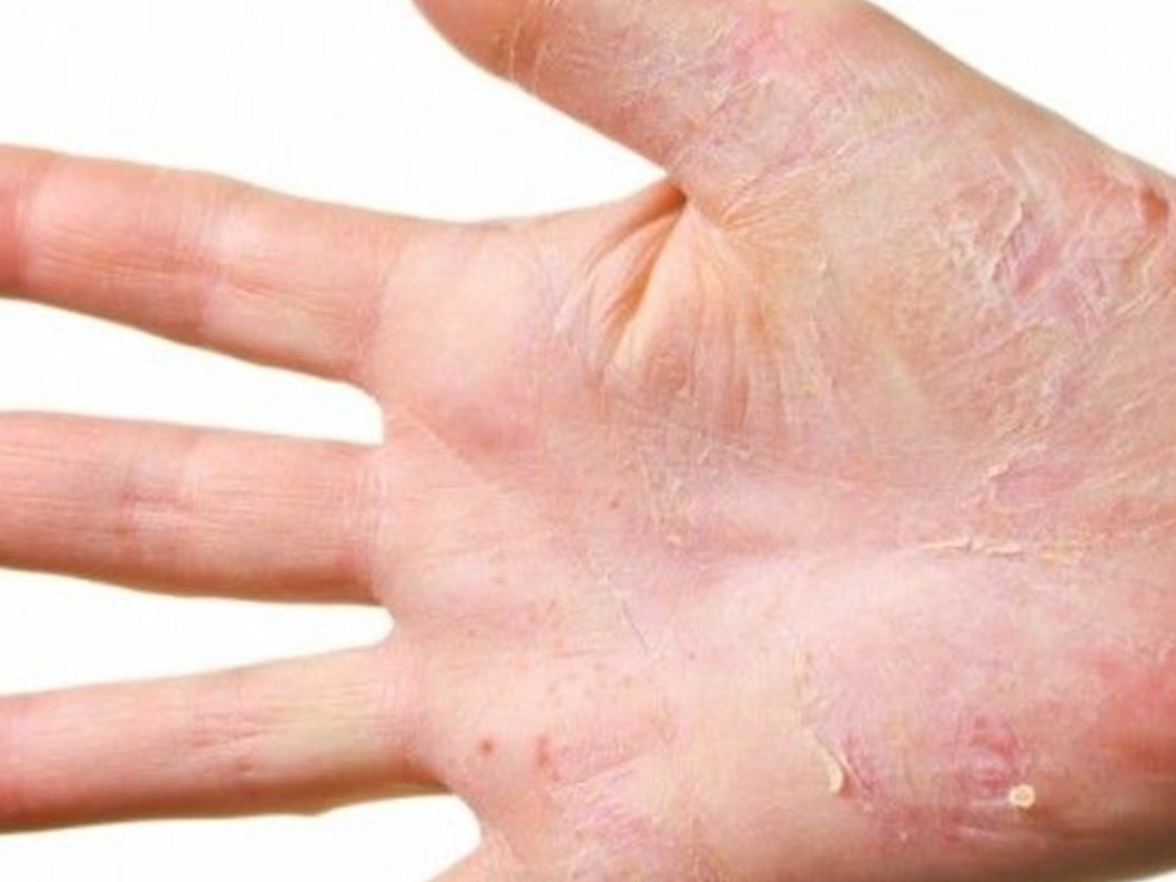 Egzamaya Iyi Gelen 10 Dogal Bitki Ens Az 4 Dilde Haberler Ve Ansiklopedi