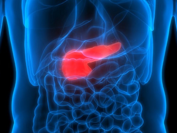 pankreas kanseri riskini artiran