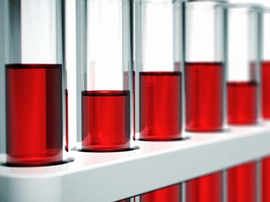 Kan Grubu 0 Olanlarda Kalp Krizi Riski Daha Dusuk Saglik Haberleri Ntv