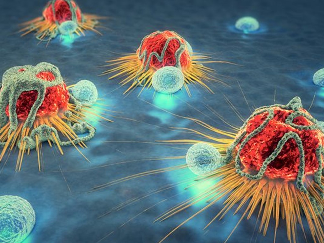 kanserle mucadelede yeni strateji olumsuz kanser kok hucresi asil topugu ndan vurulabilir mi