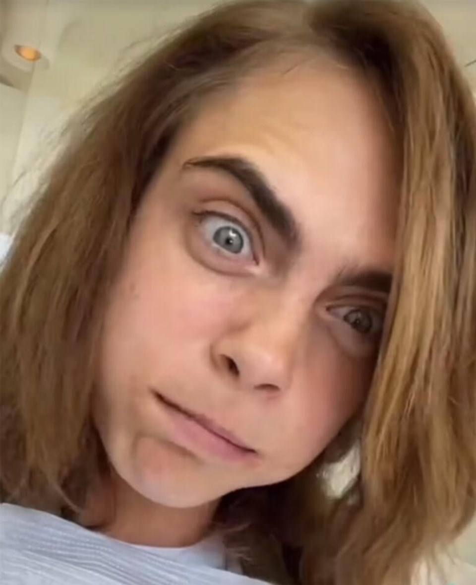 Cara Delevingne dişçi koltuğundan paylaştı: Çok ağladım - 3