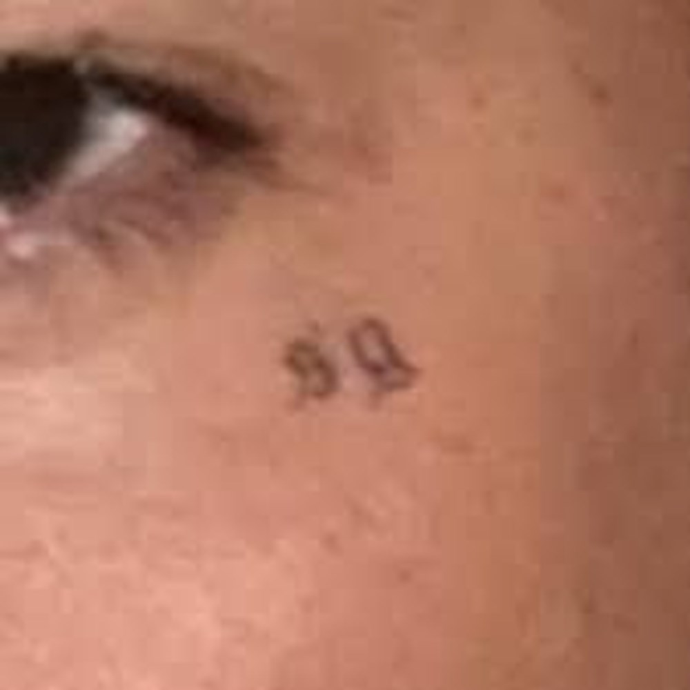 Drake yüzüne dövmeyle miskin yazdırdı - 4