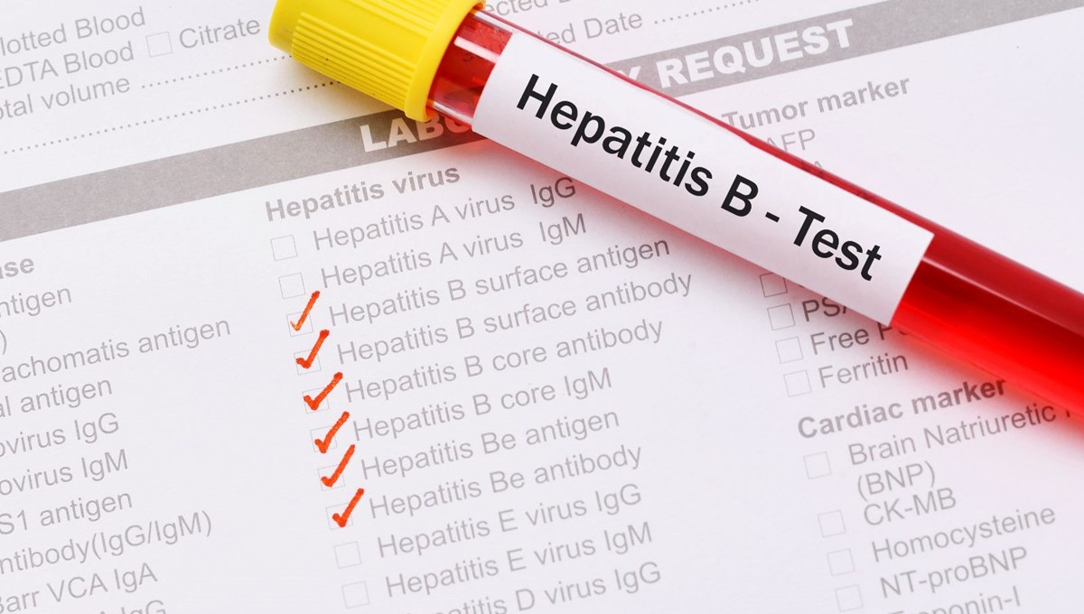 Hepatit B nedir, tanı ve tedavi yöntemleri nelerdir?