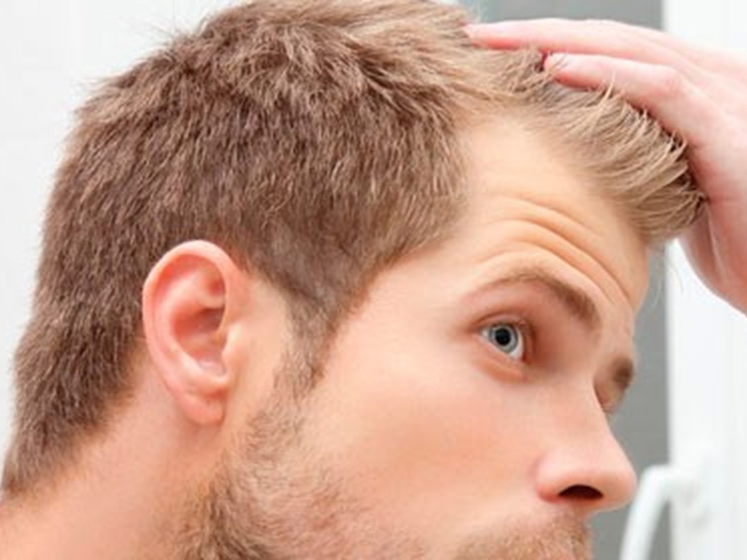 Sac Ekimi Icin En Uygun Zaman Saglik Haberleri Ntv