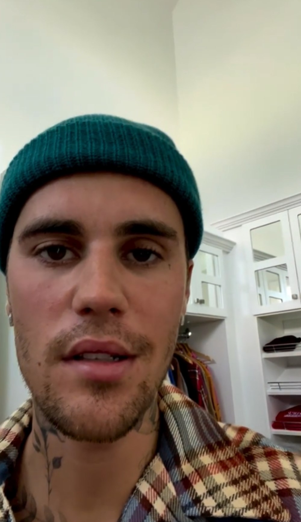 Justin Bieber nadir görülen bir sendrom nedeniyle yüz felci geçirdi - 3