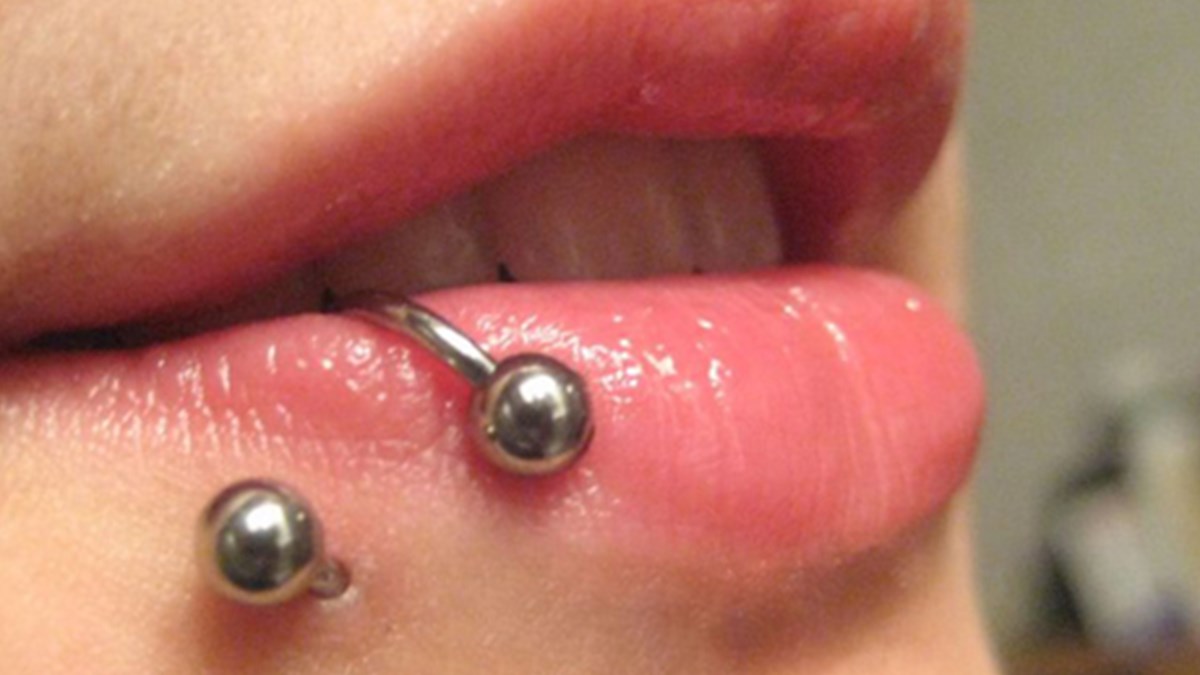 Dildeki Piercingle Tekerlekli Sandalye Kontrolu Saglik Haberleri Ntv