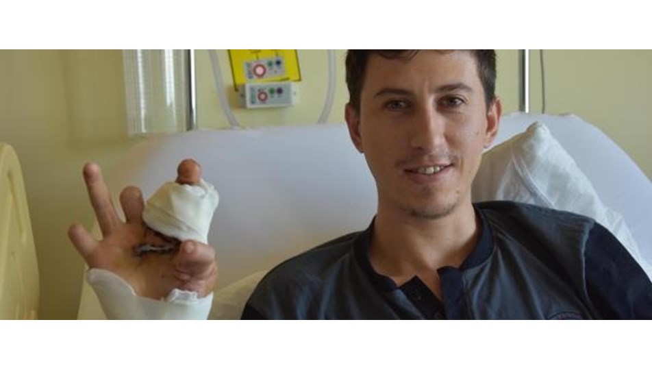 Ayak parmakları eline dikildi