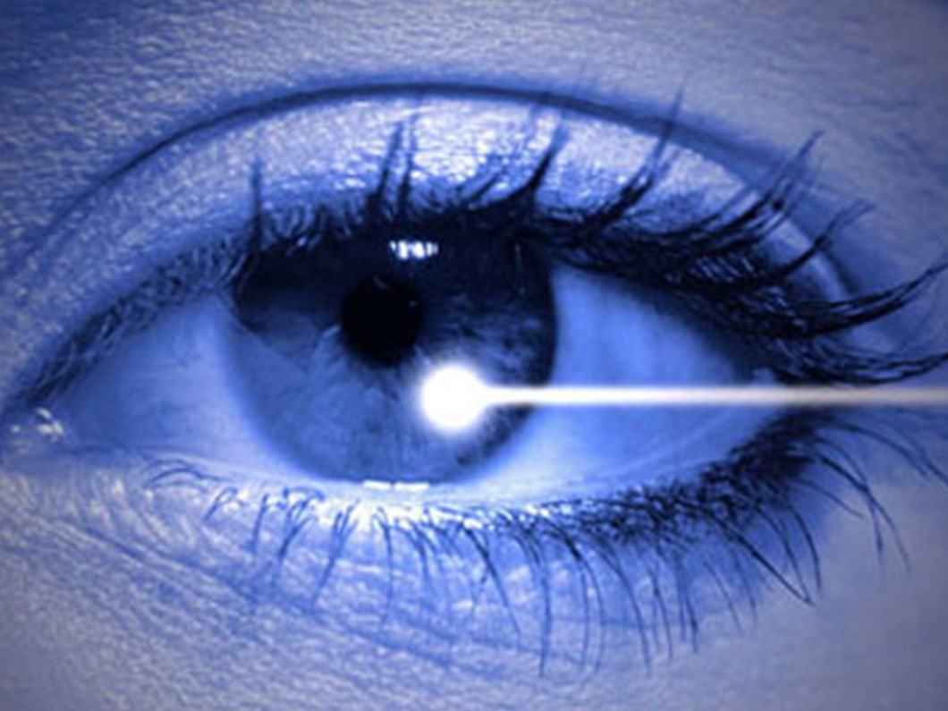 lazerle goz ameliyatinda bunlara dikkat saglik haberleri ntv