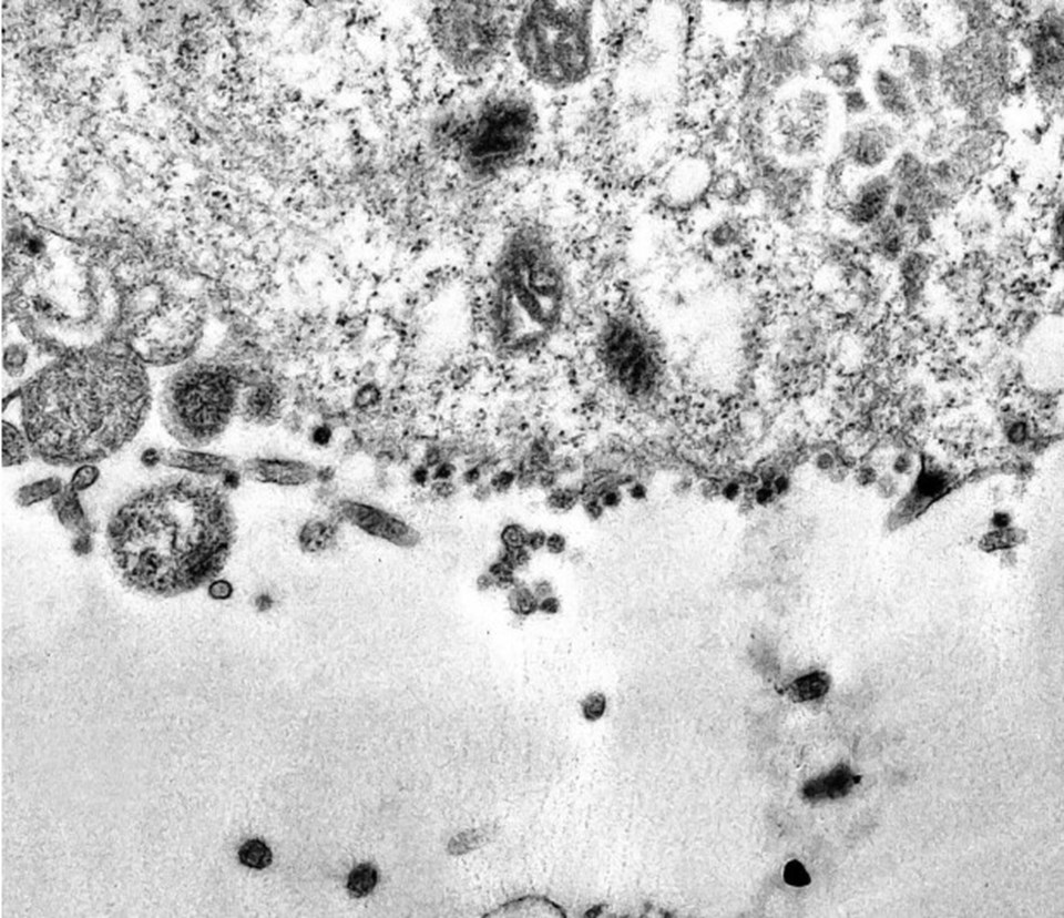 Corona virüsün hücreye saldırı anı bilim insanlarınca görüntülendi - 1