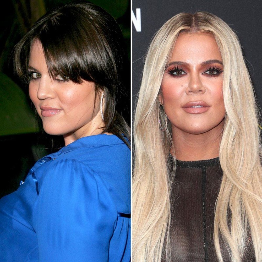 Khloe Kardashian’dan burun estetiği itirafı - 1