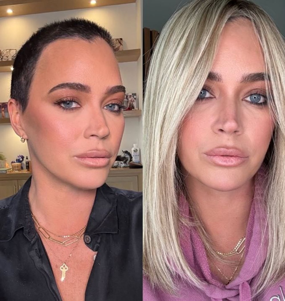 4. evre kanser teşhisi konulan Teddi Mellencamp galada: Hastalık akciğerlerine ve beynine yayılmış 76 HecTtAT7AUCTUu3gjo9QQQ