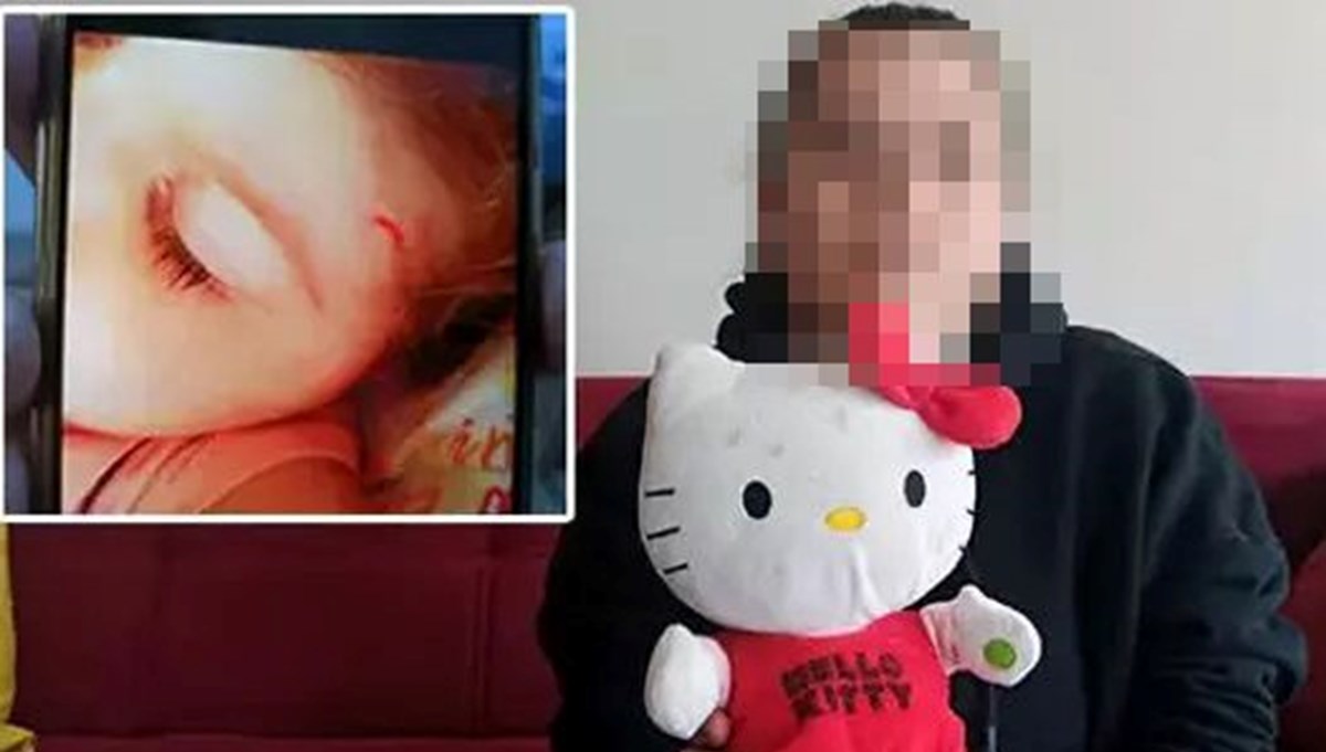 Kreşte çocuklara şiddeti oyuncak ayı ortaya çıkardı Kreşte çocuklara şiddeti oyuncak ayı ortaya çıkardı