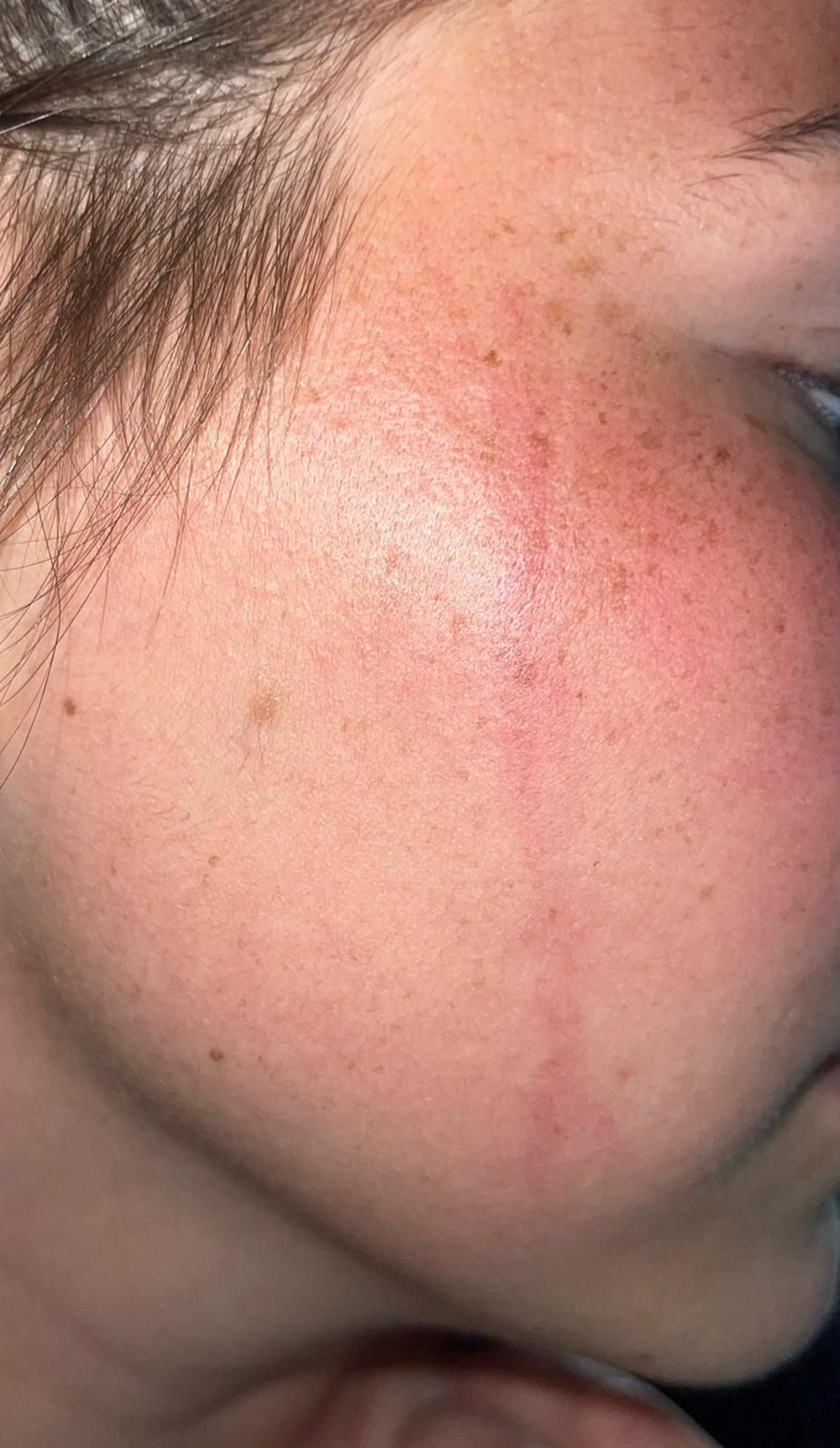 Taraftar sahada kadın futbolculara saldırdı: Erkek taraftar bize yumruk attı - 5