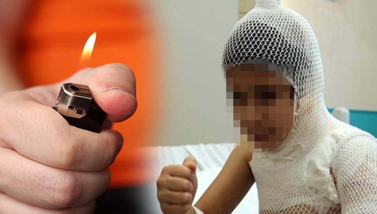 Sosyal medyada tehlikeli akım | Üzerine kolonya döküp yaktı Sosyal medyada tehlikeli akım | Üzerine kolonya döküp yaktı