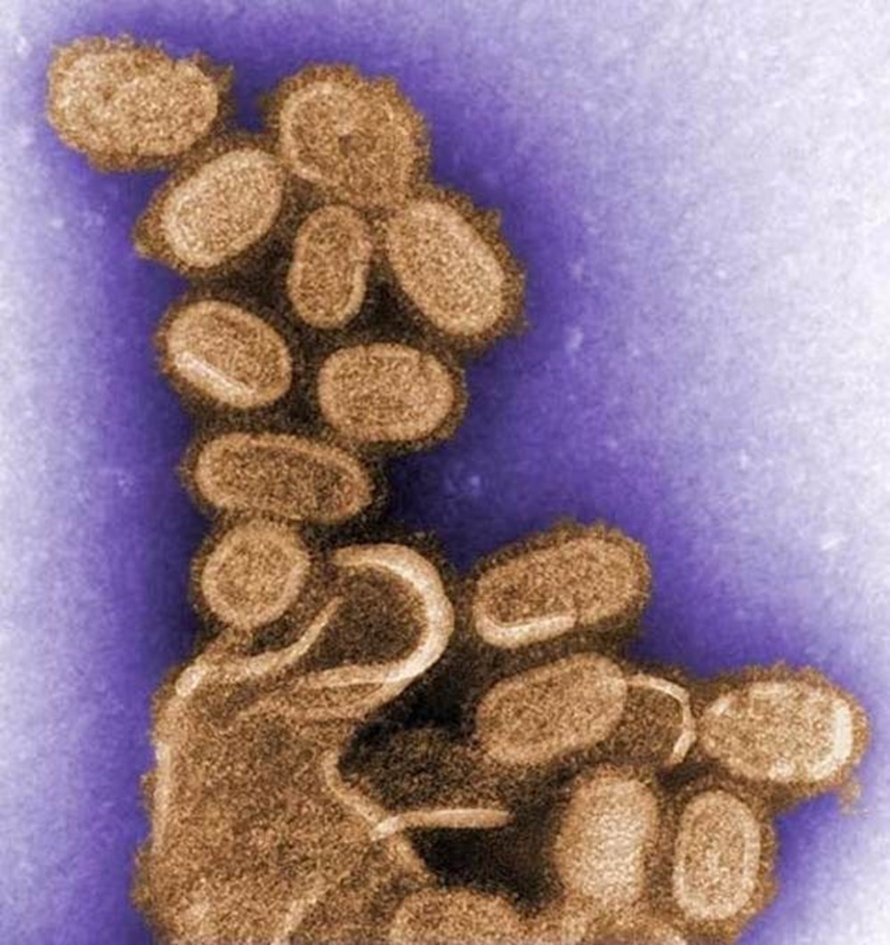 Küresel ısınma yeni pandemiye neden olur mu?: Zombi virüsler etkilediği canlıların 3'te birini öldürebilir - 2