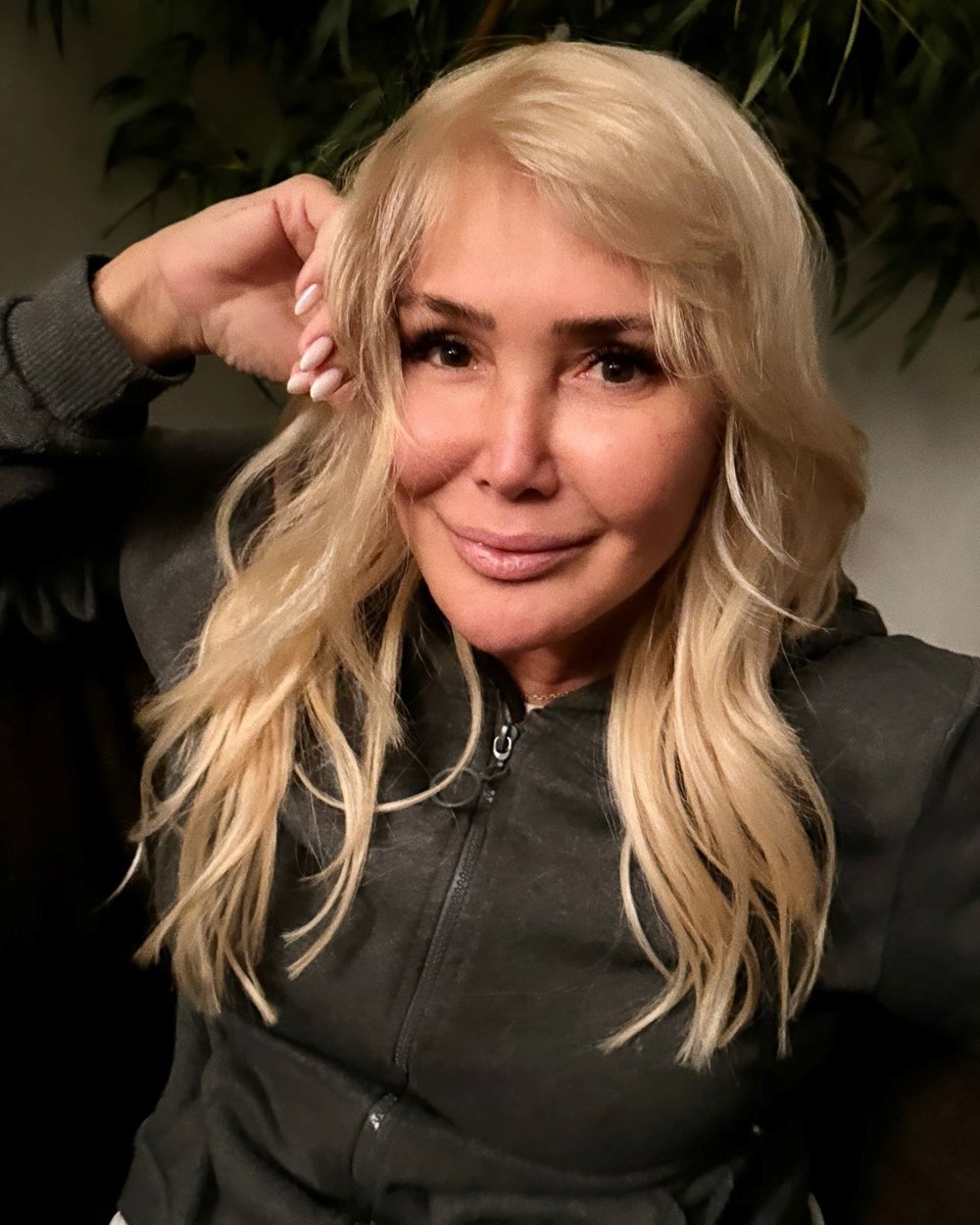 Yonca Evcimik yüzündeki değişimle gündem oldu - 1