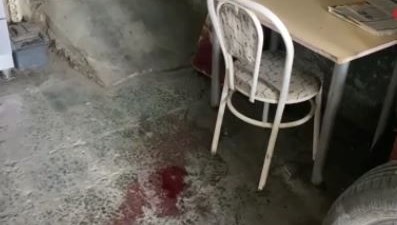 Sandalyeden düşen adam ağır yaralandı