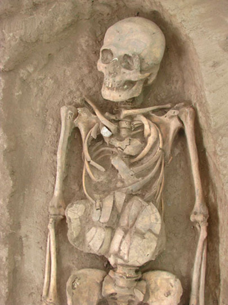 Bin yıllık kemikler arkeologları şaşırttı - 2