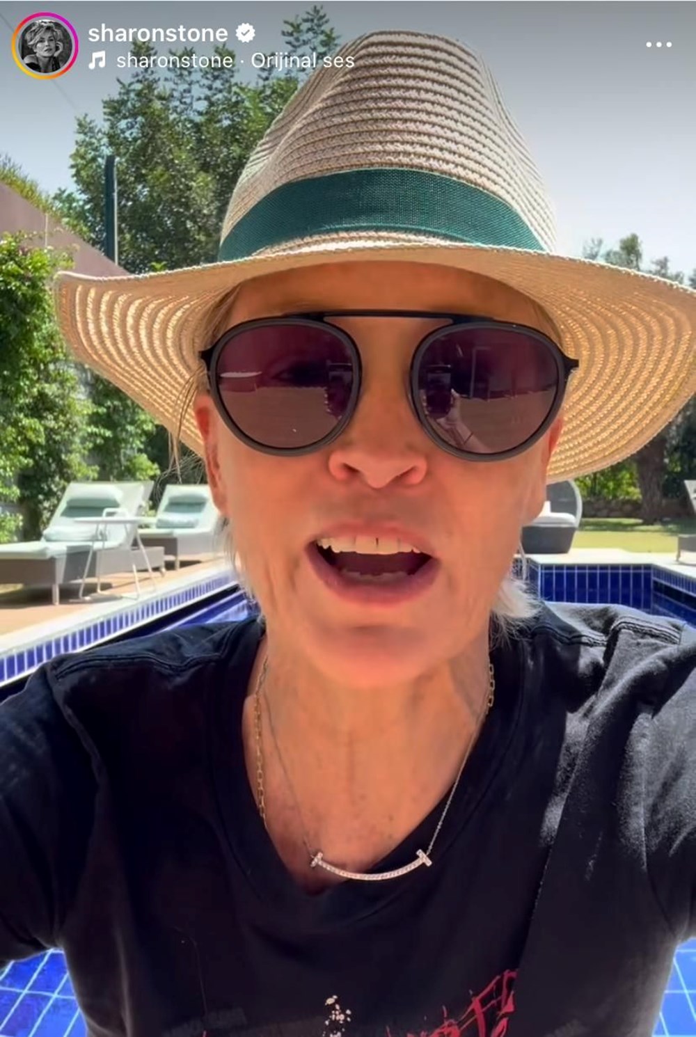 Ünlü oyuncu Sharon Stone'un gözüne ne oldu? - 3
