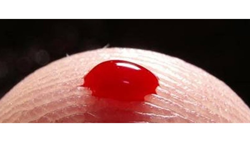 A Dan Z Ye Losemi Gercegi Saglik Haberleri Ntv