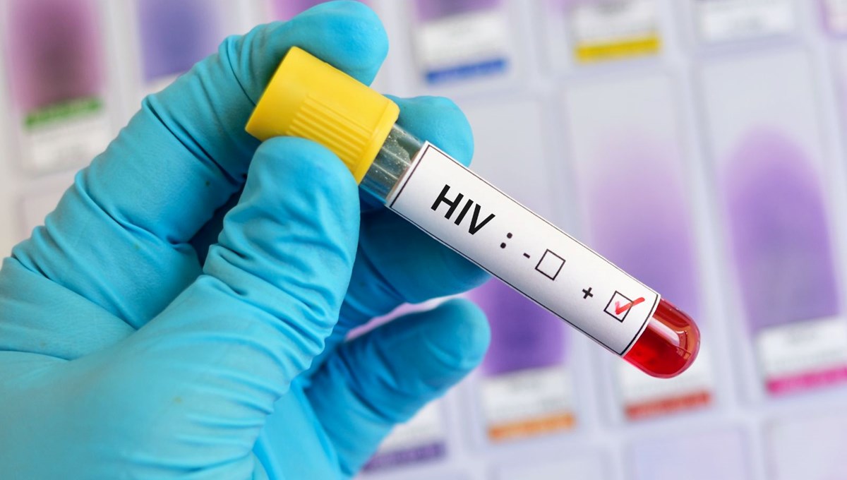 Gana'da AIDS kabusu: Bir yılda 9 bin 354 can kaybı Gana'da AIDS kabusu: Bir yılda 9 bin 354 can kaybı
