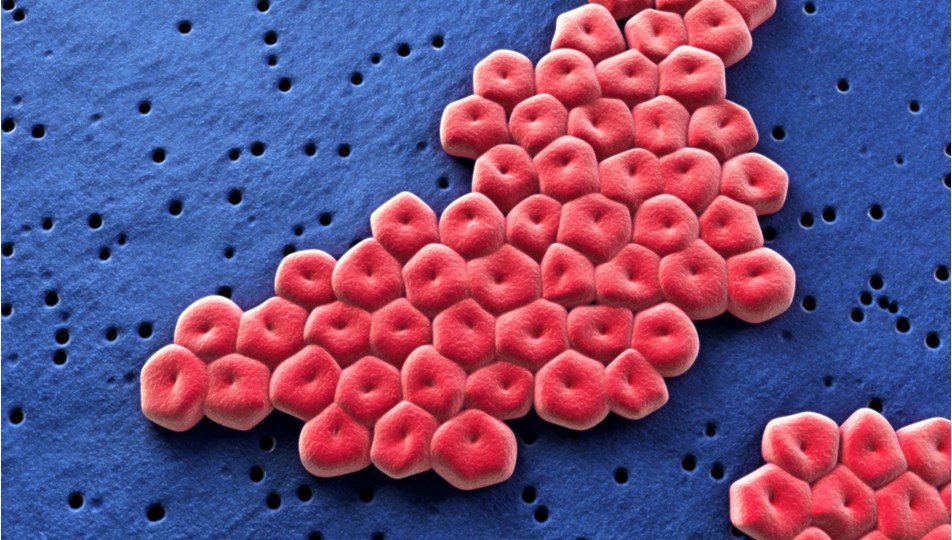 Jinekologlar uyardı: Et yiyen cinsel organ enfeksiyonu