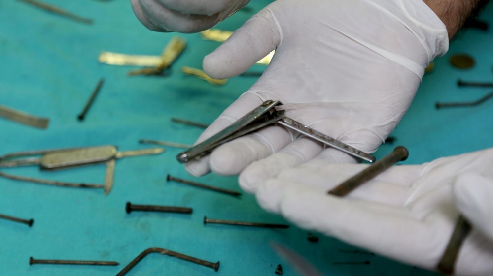Van'da kadın hastanın midesinden 158 yabancı cisim çıkarıldı - 9