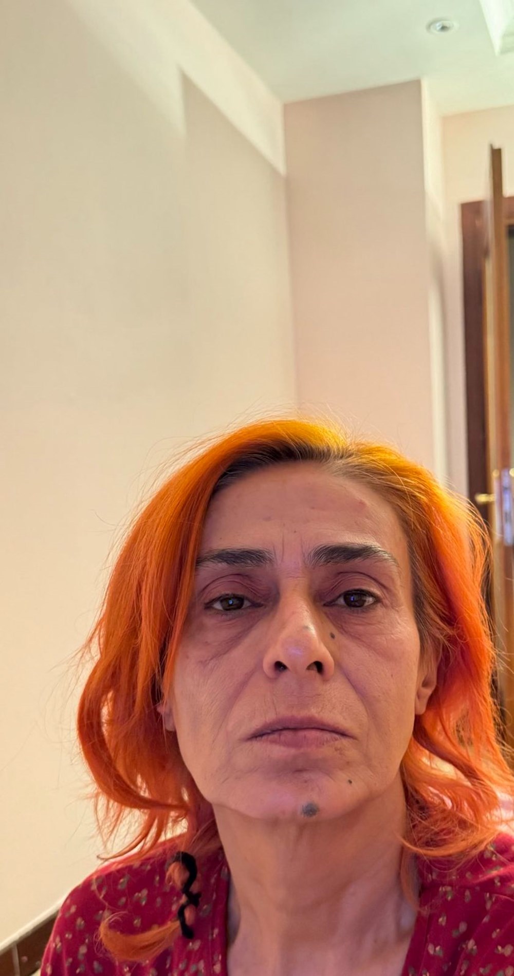 Çarpıntı'nın Emel'i Ceren Taşçı'dan çocukluk pozu (Ünlülerin çocukluk ve gençlik halleri) - 117