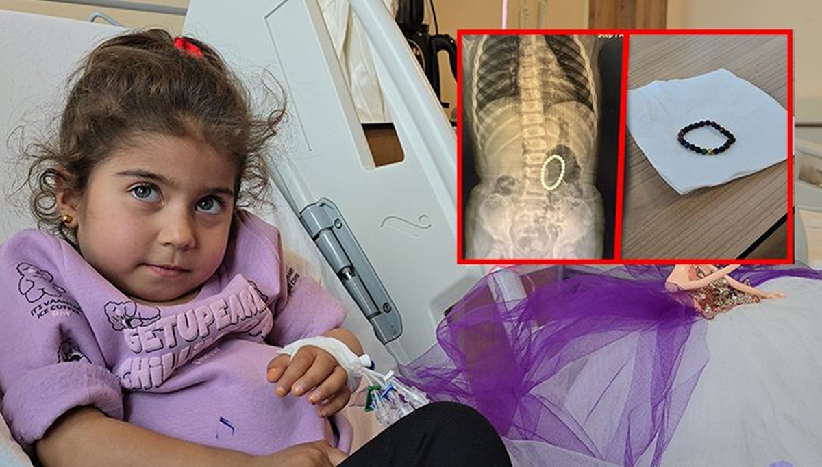 4 yaşındaki çocuğun bağırsağından çıkana doktorlar bile inanamadı: Oynadığı mıknatıslar bileklik olmuş 4 yaşındaki çocuğun bağırsağından çıkana doktorlar bile inanamadı: Oynadığı mıknatıslar bileklik olmuş