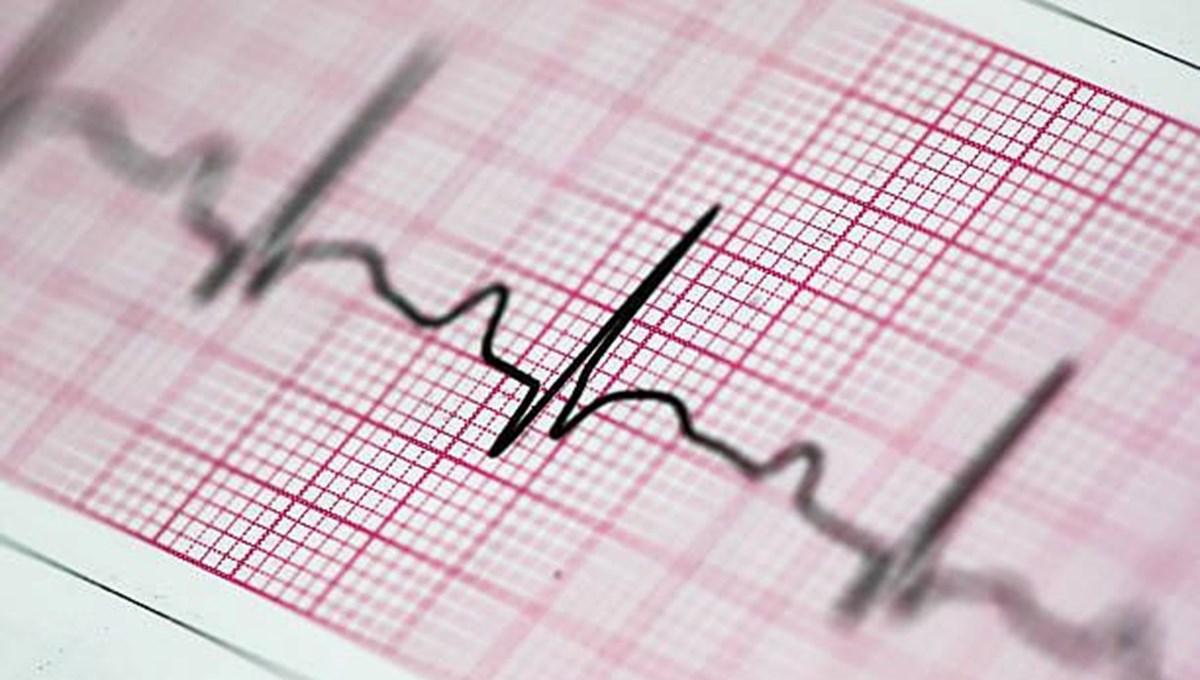 EKG nedir, nasıl çekilir? EKG neden çekilir?