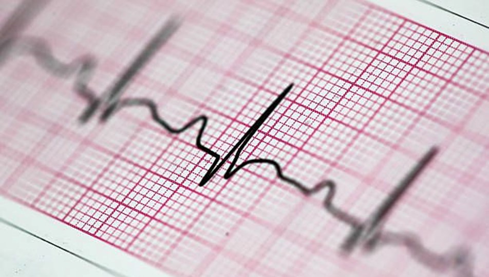 Bilim insanlarından düzensiz kalp atışını tespit eden kulaklık: 2 yıl içinde EKG'nin yerini alabilir
