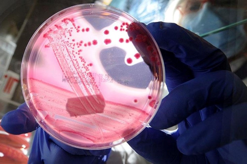 AP2A1 Proteinini Baskılayarak Yaşlanmayı Durdurmak: Bilim Dünyasından Çığır Açan Keşif 72 JL2AiyylK0SVqvhwPZ2 pQ