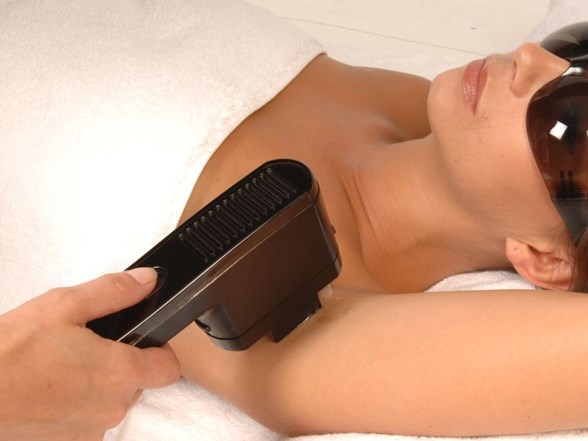 yaz aylarinda lazer epilasyon