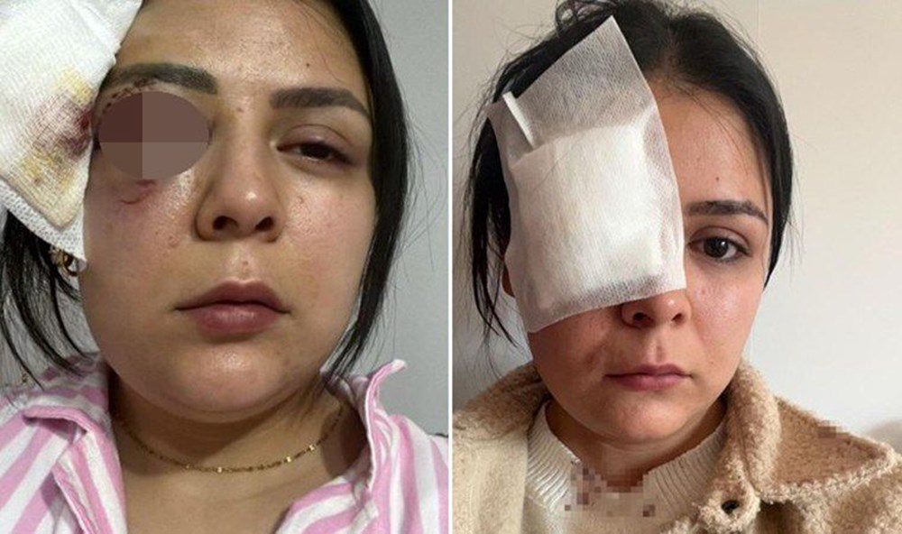 Yolda yürüyen genç kıza yumruklu saldırı - 3