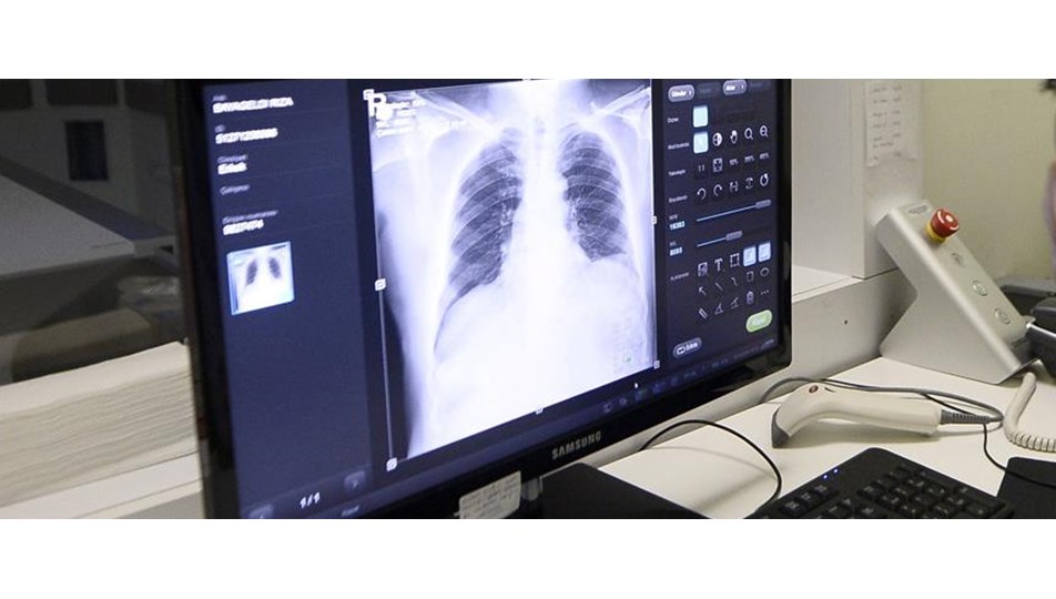 turkiye de ilk kez kanser hastasina