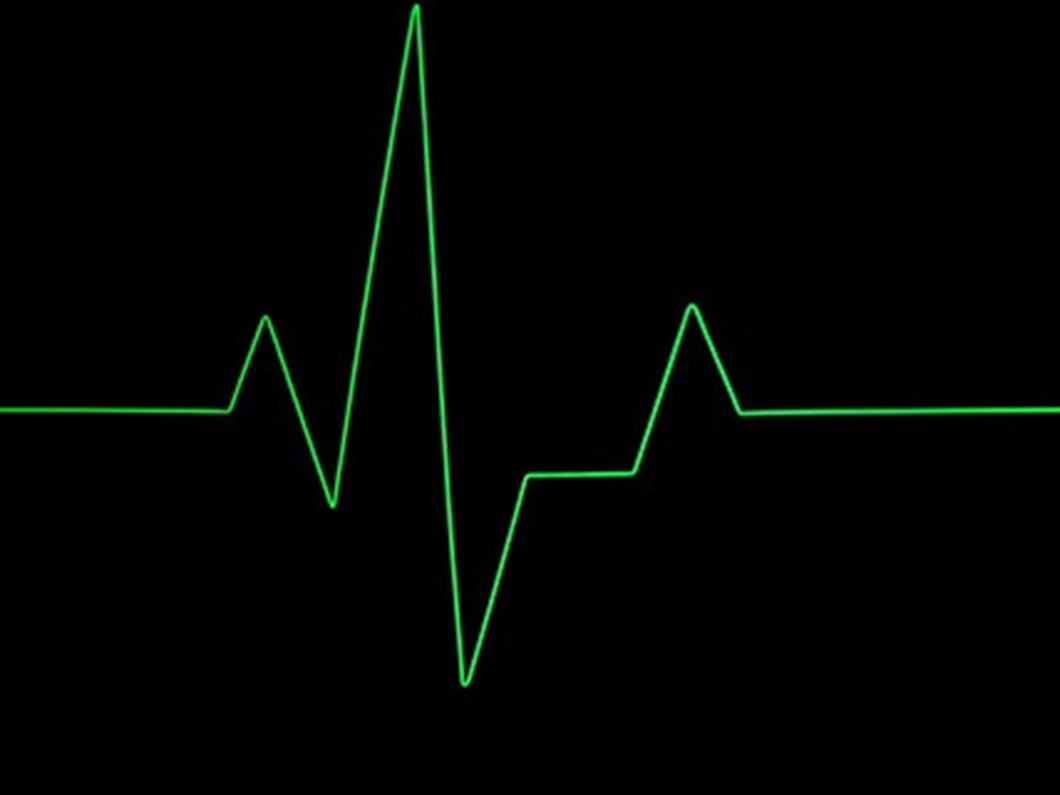 Kalbiniz Cok Mu Hizli Atiyor Saglik Haberleri Ntv