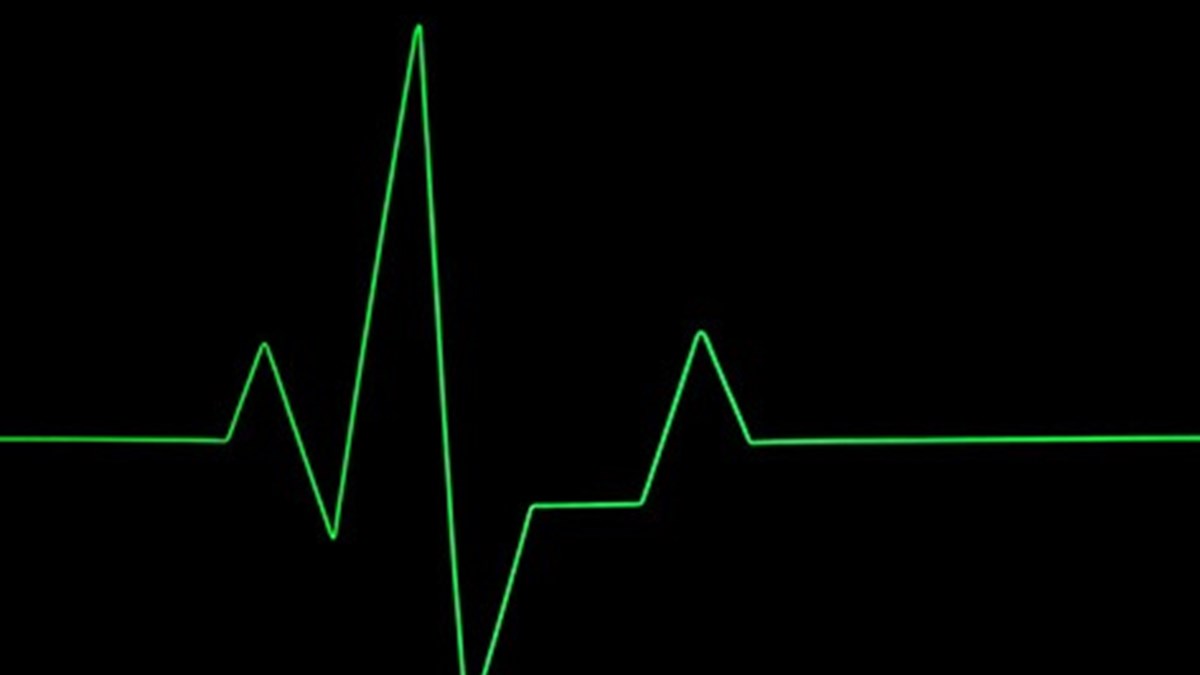 Kalbiniz Cok Mu Hizli Atiyor Saglik Haberleri Ntv