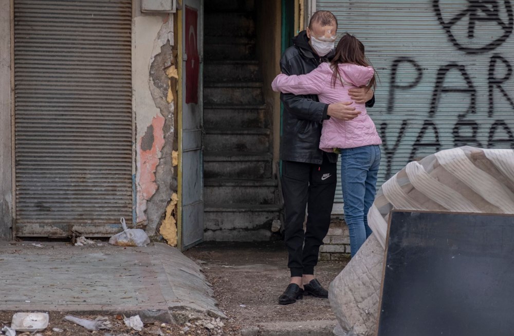 Cilt kanserinden yüzünü kaybeden baba: Kızımı öpmeyi çok özledim - 3