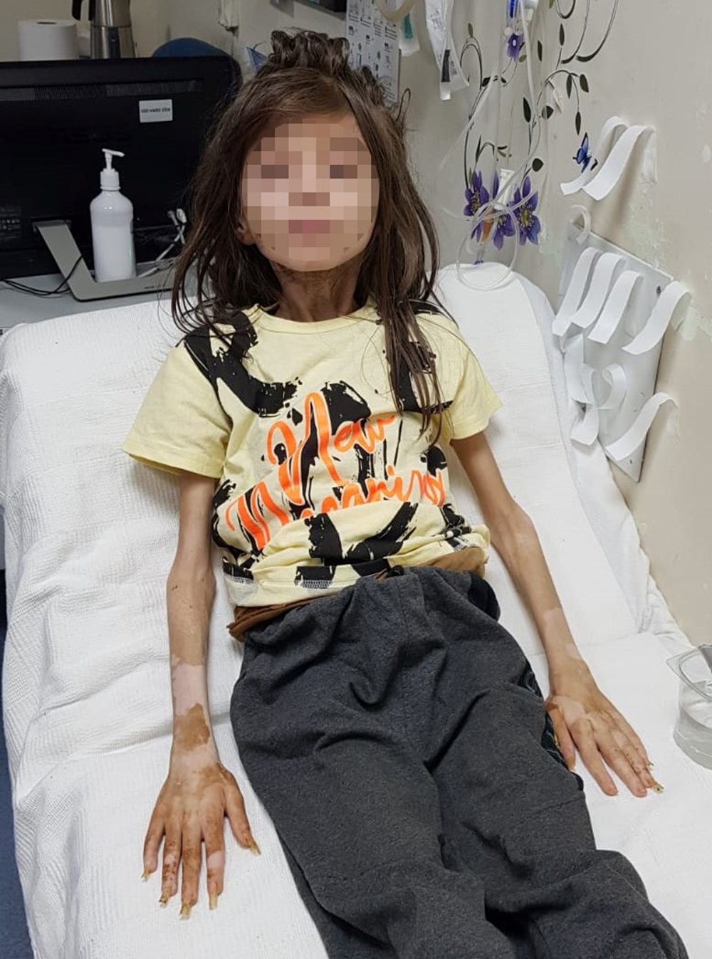 Bursa'da çöp evde korku dolu 1 yıl: Anne ile teyze birbirilerini suçladı - 9
