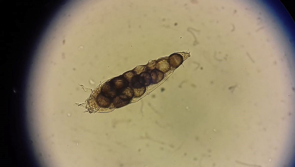 İnsan yüzünde yüzbinlerce akar yaşıyor: Demodex nedir?