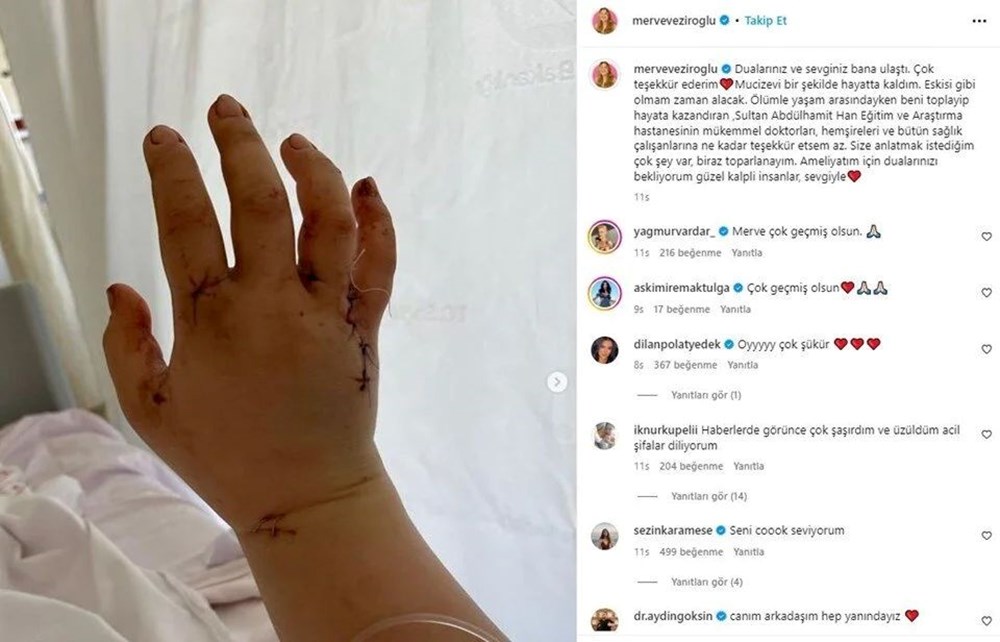 Eşi tarafından 32 kez bıçaklanan YouTuber Merve Veziroğlu yaşadıklarını anlattı: Çok yalvardım, ‘öleceksin’ dedi - 6