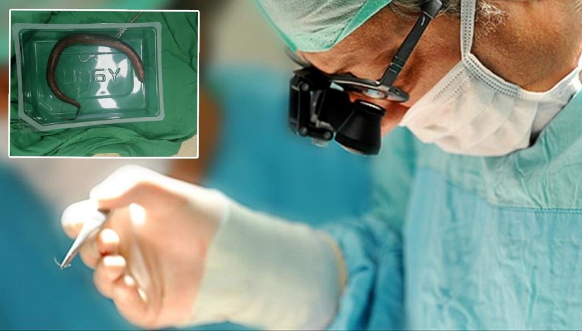 Karnından canlı yılan balığı çıktı