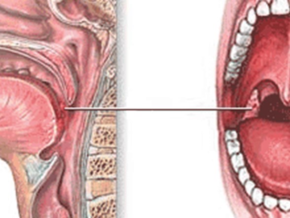 ms hastaligi hakkinda merak