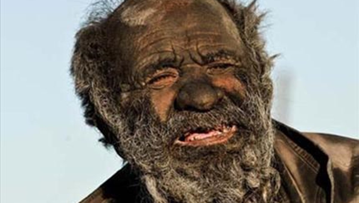 65 yıldır yıkanmayan adam: Amoo Hadji