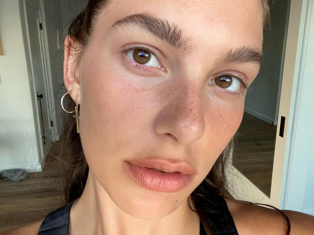 Güneş yanığına iyi gelen en doğal çözümler - 4