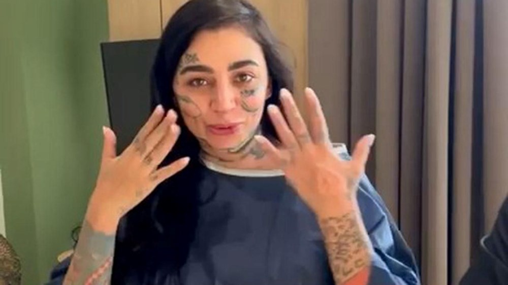 Ünlü fenomenin acı sonu: İstanbul'da reklam anlaşmalı estetik ameliyatı ölümle sonuçlandı - 3